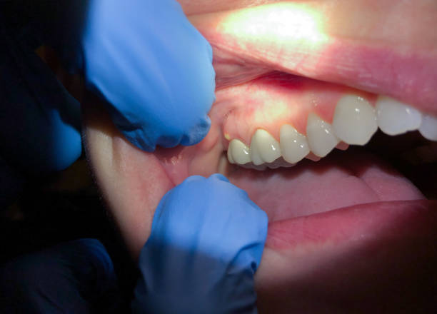 Best Emergency Dental Care for Trauma or Injury in Rio Rancho Estates, NM