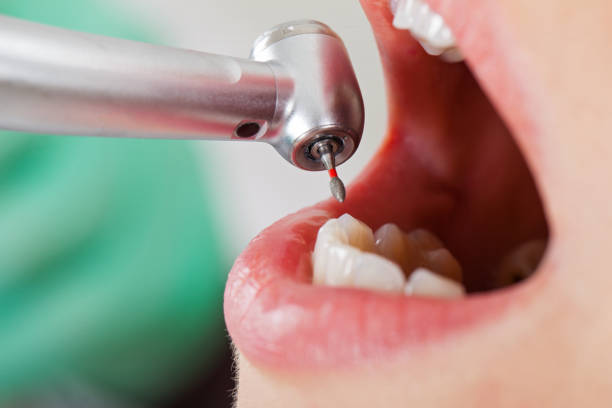 Best Walk-In Emergency Dentist in Rio Rancho Estates, NM